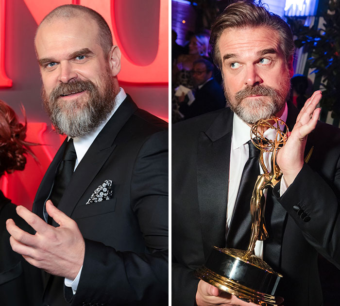 David Harbour's plastic surgery and weight loss transformation ahead of the 2026 Emmys.