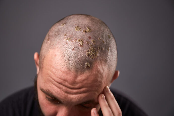 57 People Caught Their Partners In These Gross Acts And Could Never Look At Them The Same