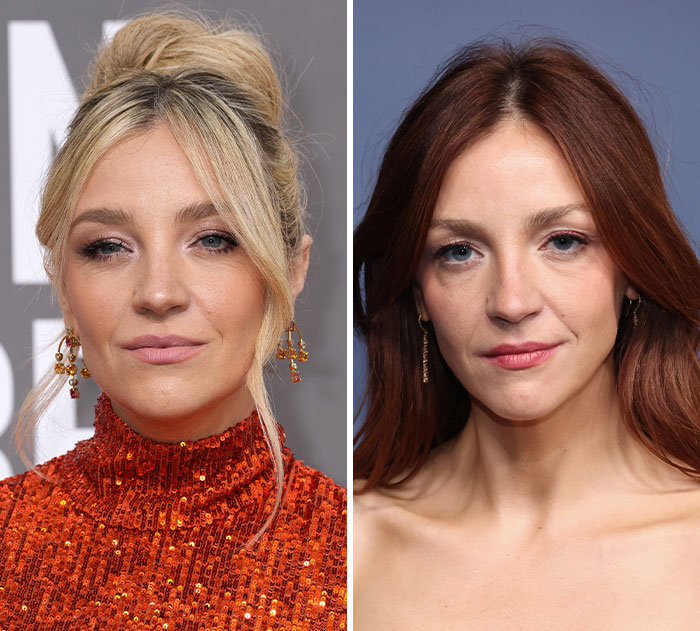Blonde and redhead looks of a star, displaying a plastic surgery and weight loss transformation for the 2026 Emmys.