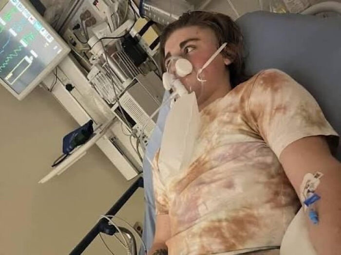 17-Year-Old Pulled A Man From A Burning Tent At A Hamilton Park Encampment