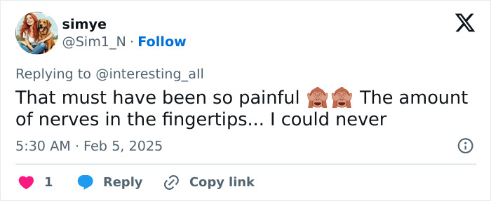 Social media comment highlighting the pain of a fingertip tattoo due to the concentration of nerves. Social media comment highlighting the pain of a fingertip tattoo due to the concentration of nerves.