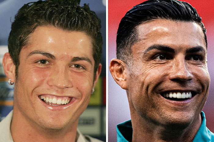 Cristiano Ronaldo before and after looksmaxxing, showing transformations hinted at by plastic surgeons.