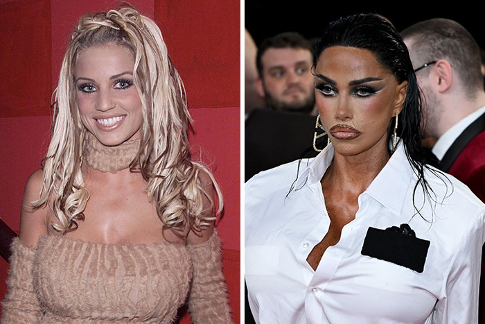 Katie Price before and after corrective surgery; her latest appearance sparks concern. Katie Price before and after corrective surgery; her latest appearance sparks concern.