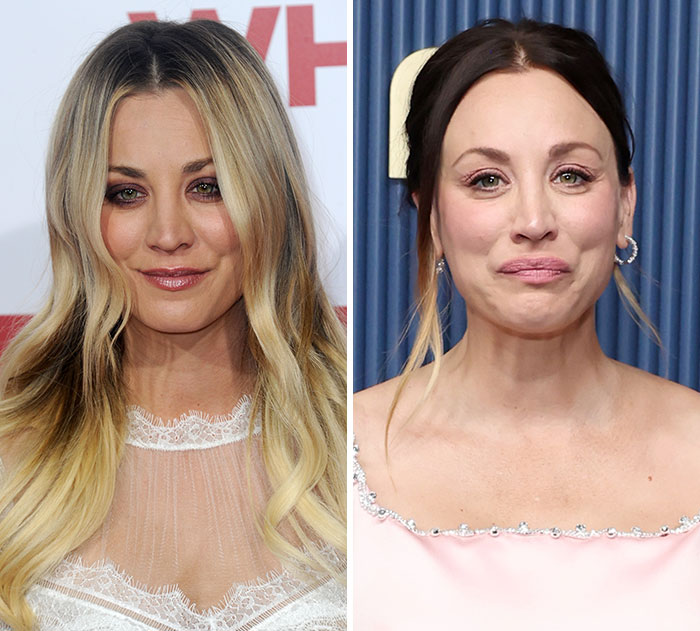 Kaley Cuoco's plastic surgery and weight loss transformation ahead of the 2026 Emmys.