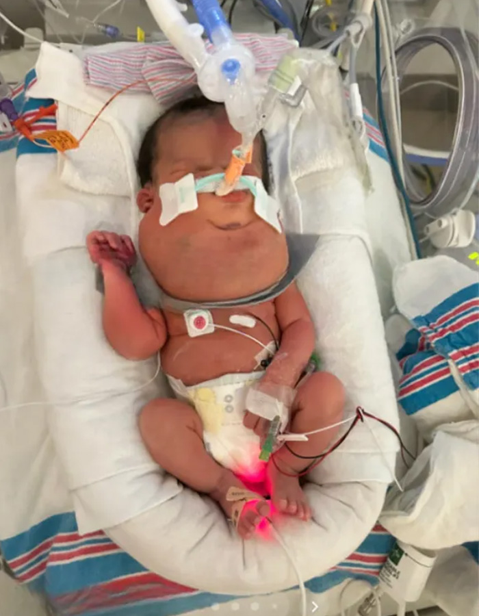 A newborn baby receiving medical care in an incubator after a routine scan diagnosis. A newborn baby receiving medical care in an incubator after a routine scan diagnosis.