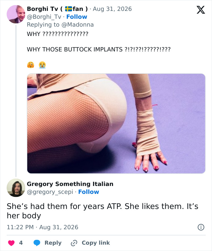 Madonna Slammed After Fans Noticed Odd Details In Latest Photos: "What's Happening Here?" Madonna Slammed After Fans Noticed Odd Details In Latest Photos: "What's Happening Here?"