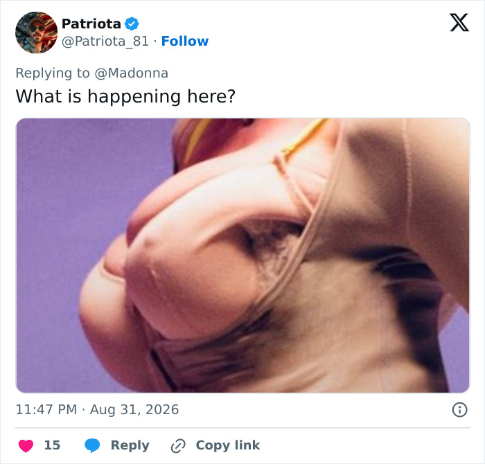 Madonna Slammed After Fans Noticed Odd Details In Latest Photos: "What's Happening Here?" Madonna Slammed After Fans Noticed Odd Details In Latest Photos: "What's Happening Here?"