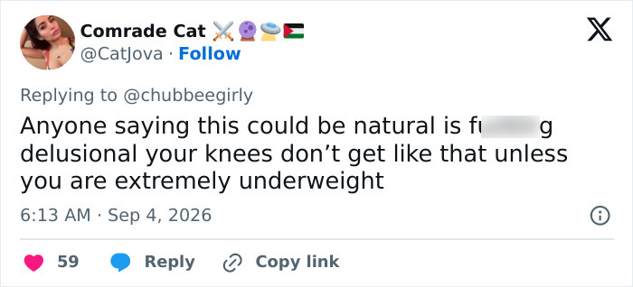 Screenshot of a tweet criticizing a Victoria's Secret ad model, calling her extremely underweight. Screenshot of a tweet criticizing a Victoria's Secret ad model, calling her extremely underweight.
