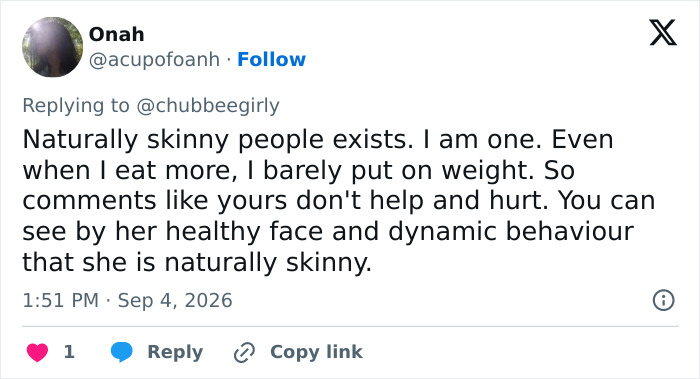Screenshot of a tweet from Onah about model backlash, stating naturally skinny people exist and are healthy. Screenshot of a tweet from Onah about model backlash, stating naturally skinny people exist and are healthy.