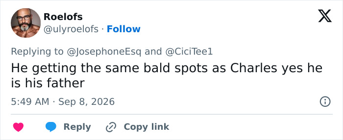 A tweet by Roelofs comparing Prince Harry's bald spots to King Charles', discussing Prince Harry's paternity. A tweet by Roelofs comparing Prince Harry's bald spots to King Charles', discussing Prince Harry's paternity.