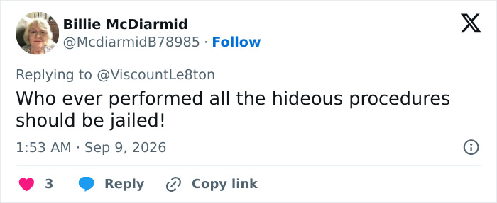 Screenshot of a tweet by Billie McDiarmid, discussing Katie Price's corrective surgery. Screenshot of a tweet by Billie McDiarmid, discussing Katie Price's corrective surgery.