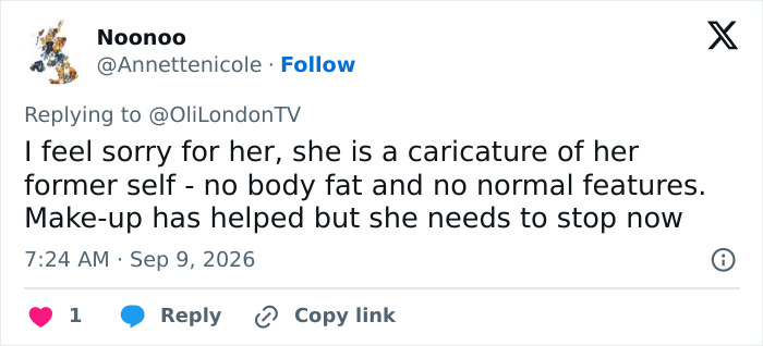 A social media comment showing concern for Katie Price's latest appearance after corrective surgery. A social media comment showing concern for Katie Price's latest appearance after corrective surgery.