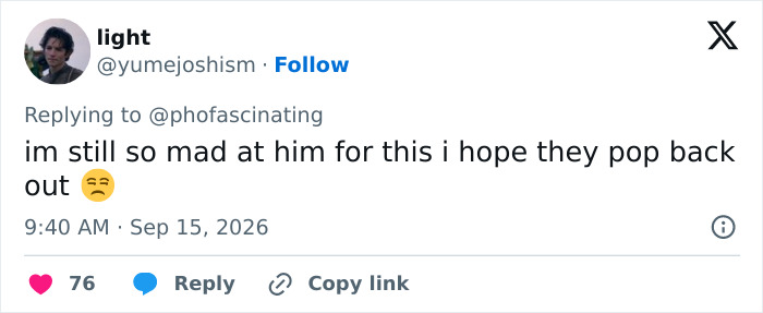 Netizens react to Adam Driver plastic surgery speculation, with a user expressing anger over the change.
