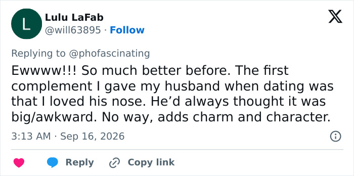 Lulu LaFab expresses disappointment about Adam Driver's plastic surgery speculation, preferring his prior look.