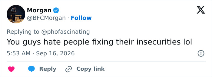 Netizens react to Adam Driver's plastic surgery speculation; a user suggests people hate others fixing insecurities.