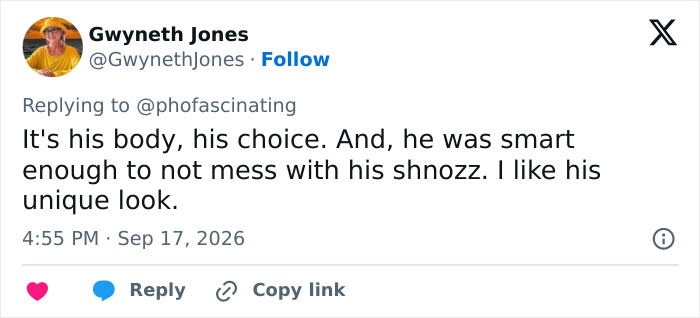 Netizens discuss Adam Driver's plastic surgery speculation; a user states, It's his body, his choice.