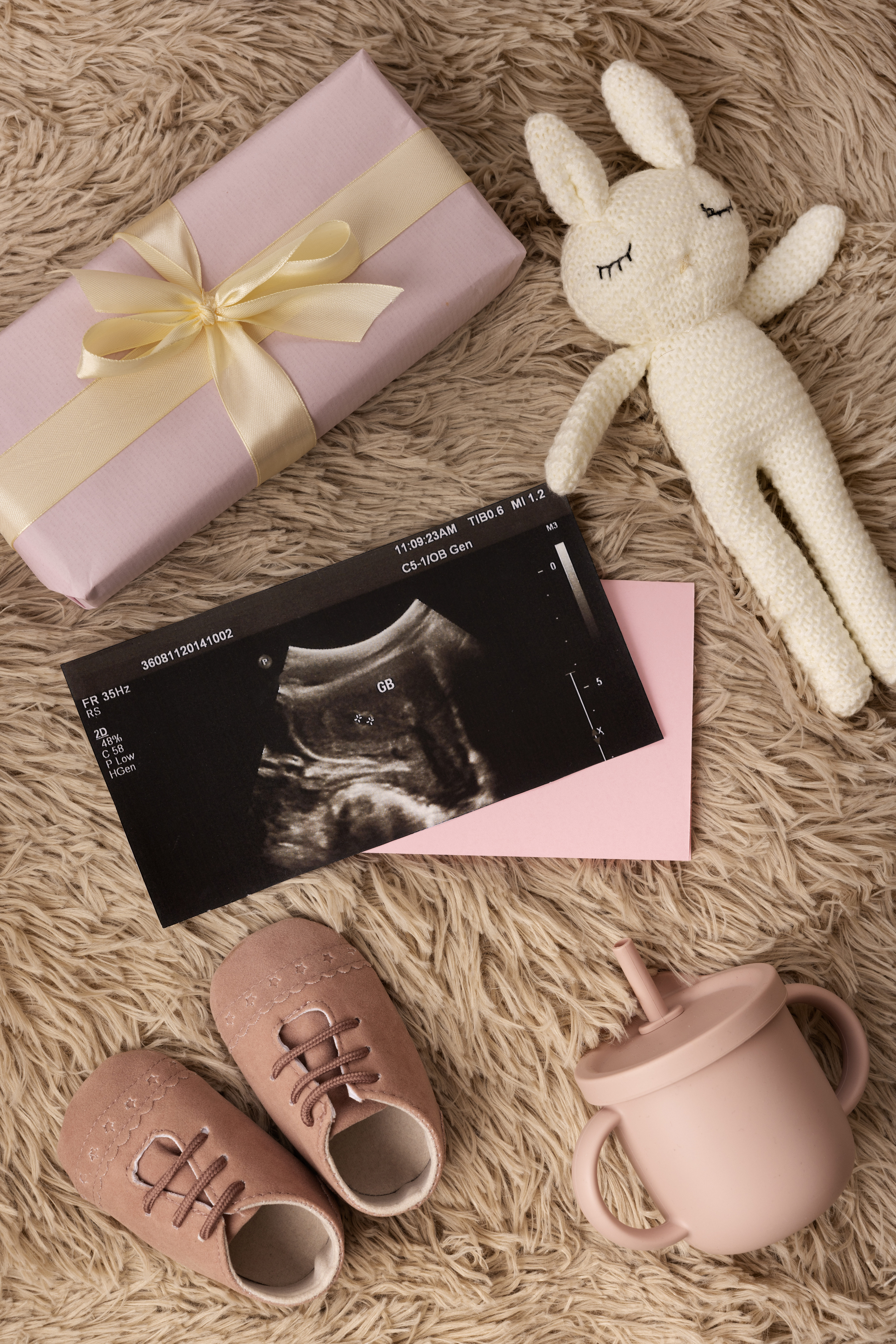 An ultrasound image of twins, baby shoes, and gifts representing twin newborns. An ultrasound image of twins, baby shoes, and gifts representing twin newborns.