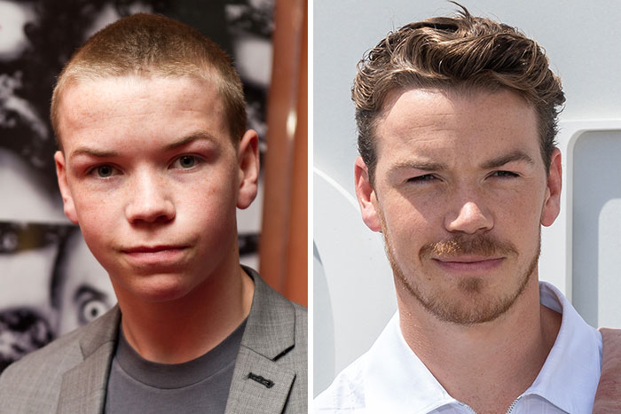 Will Poulter's looksmaxxing journey, with before and after comparisons suggesting plastic surgeons' work.