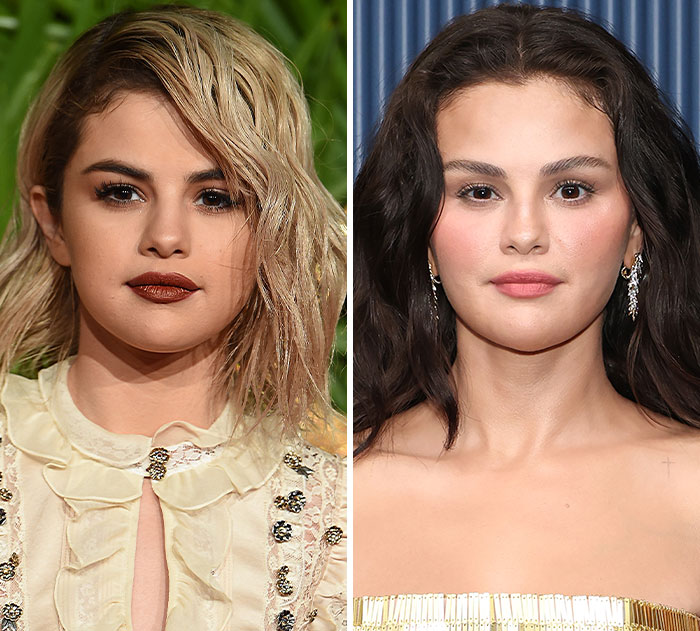 Selena Gomez's plastic surgery and weight loss transformation ahead of the 2026 Emmys.