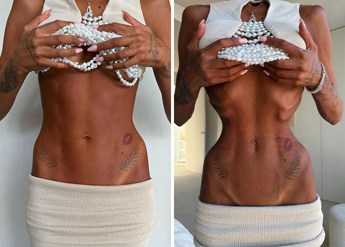 A close-up of a woman's torso showcasing an extremely narrow waist from plastic surgery A close-up of a woman's torso showcasing an extremely narrow waist from plastic surgery