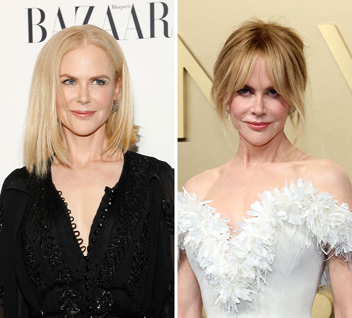 Nicole Kidman's plastic surgery and weight loss transformation at the Emmys.