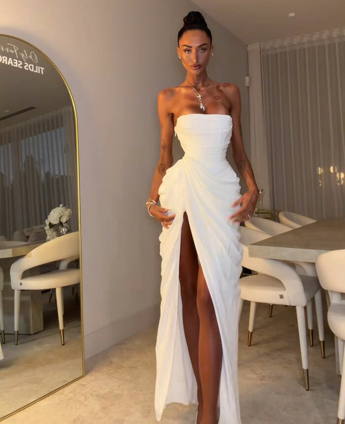 Influencer posing in a white gown showcasing her body shape after plastic surgery. Influencer posing in a white gown showcasing her body shape after plastic surgery.