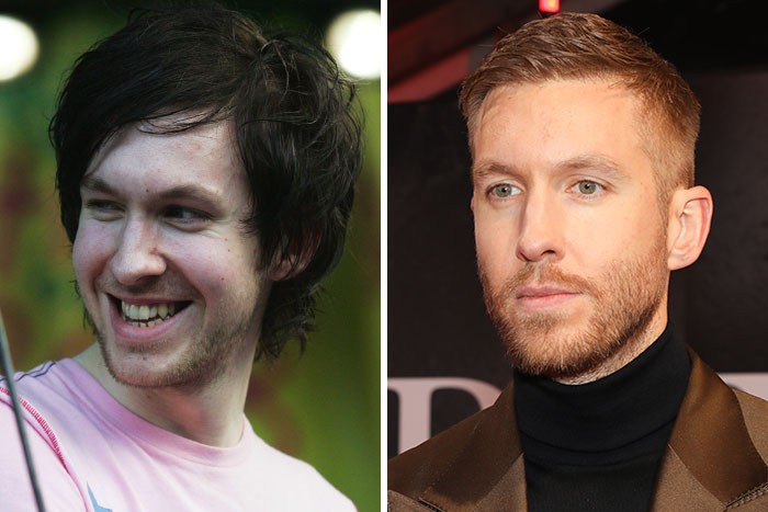 Calvin Harris's looksmaxxing evolution, displaying the impact of rumored plastic surgeon procedures.