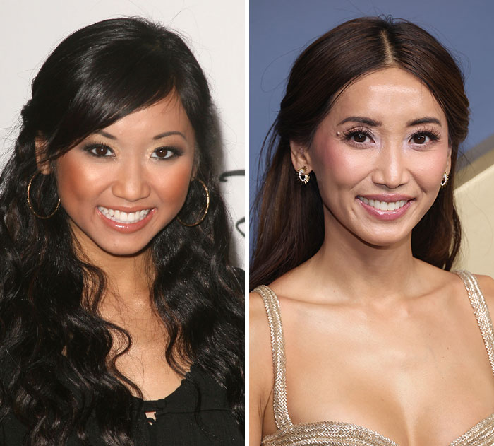 Brenda Song's stunning plastic surgery and weight loss transformation at the Emmys.
