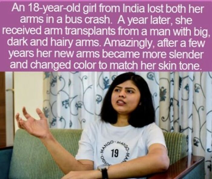 An Indian girl gesturing with her hand, illustrating one of the interesting facts about arm transplants