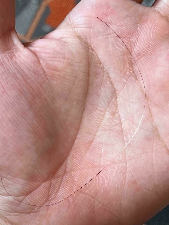 A palm with one white and one dark hair, highlighting a fascinating body quirk.
