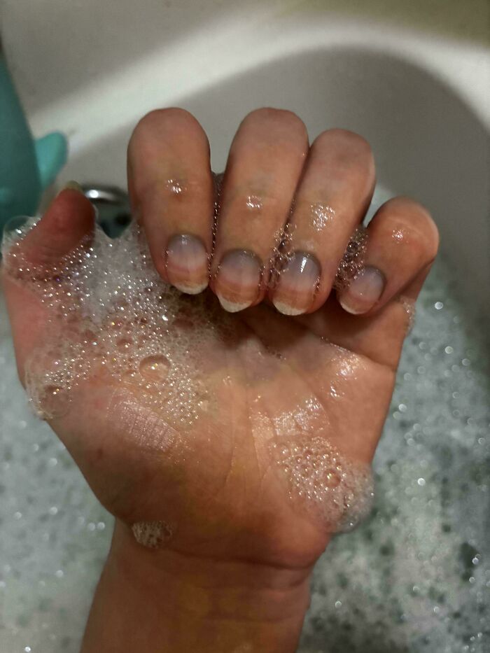 A hand covered in soap bubbles, showing a body quirk of unusually colored fingernails.
