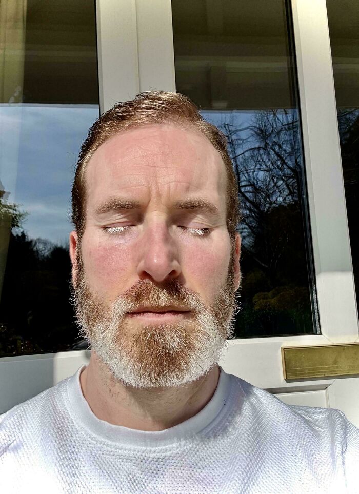 A man with closed eyes and a beard, showcasing a body quirk in the sunlight.