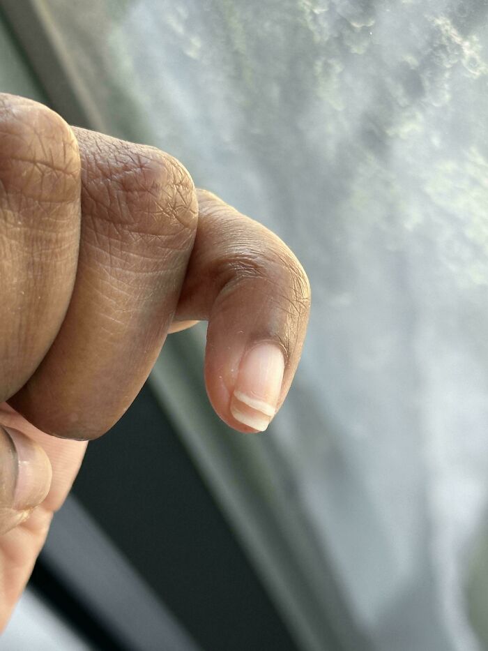 A close-up of a finger, revealing a fascinating body quirk.