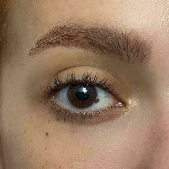 A close-up of a person's eye with a unique mole on the iris, an unexpected body quirk.