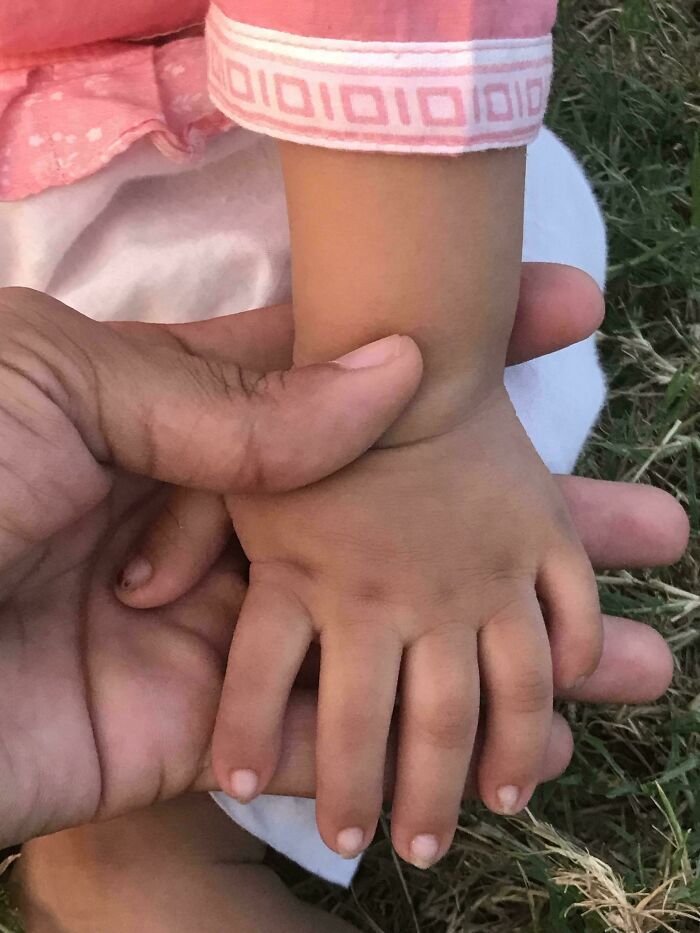 An adult hand holds a baby's hand, showcasing a rare body quirk: the baby's unusually long fingers.