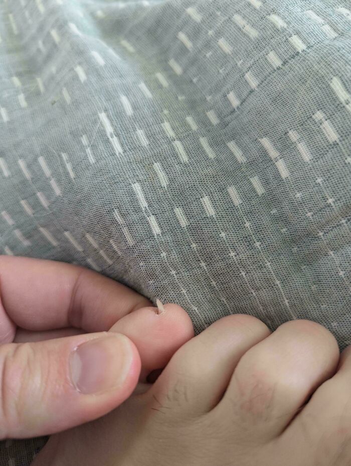 A person displaying a rare body quirk of an unusually long nail, fascinating people with unique body quirks.