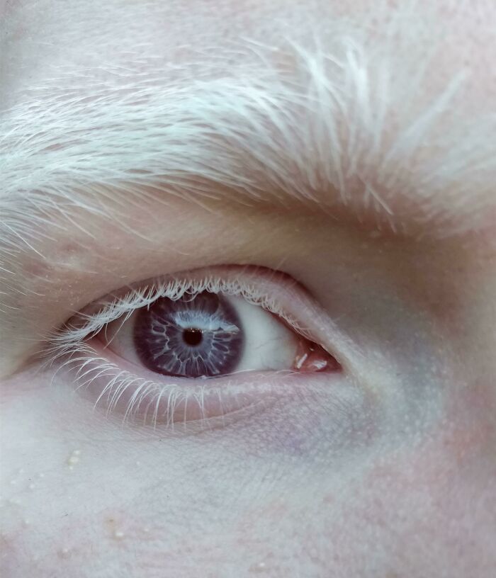 Close-up of an eye with a rare body quirk: a unique, intricate purple iris and very light eyelashes.