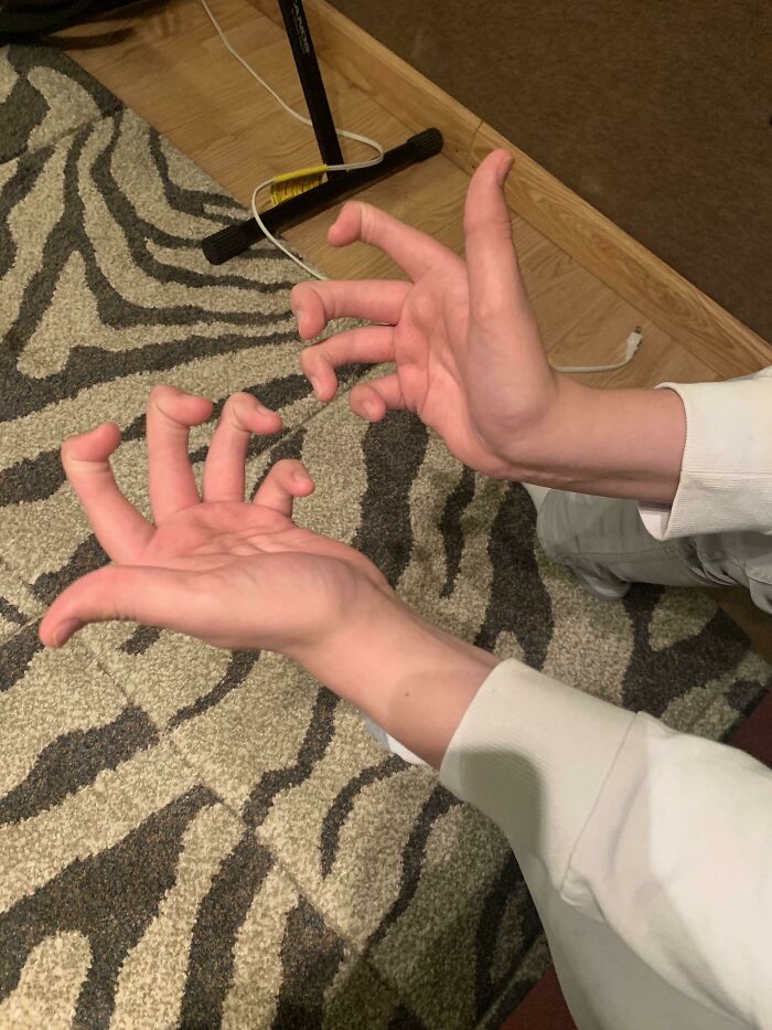 A pair of hands showcasing unusual finger flexibility, highlighting a rare body quirk.