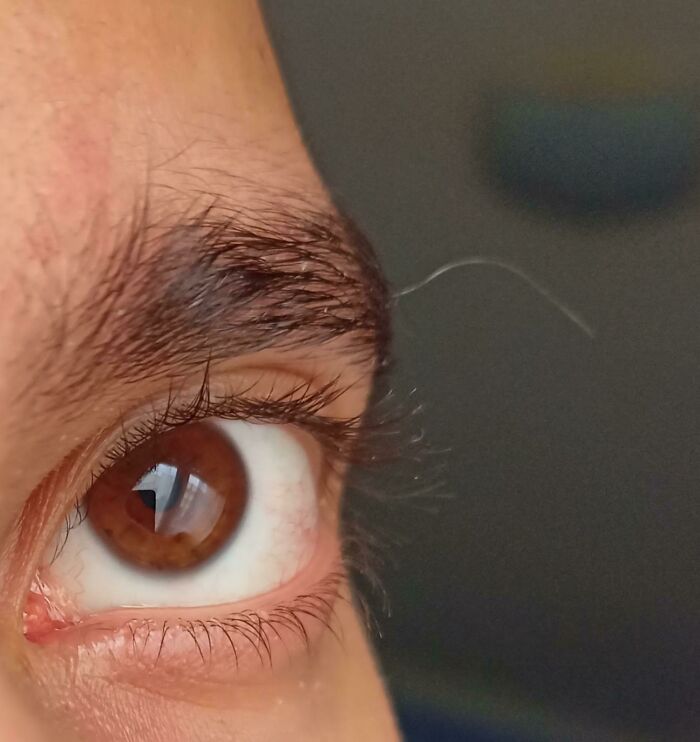A close-up of an eye and eyebrow with a single long, white eyebrow hair, showcasing body quirks.