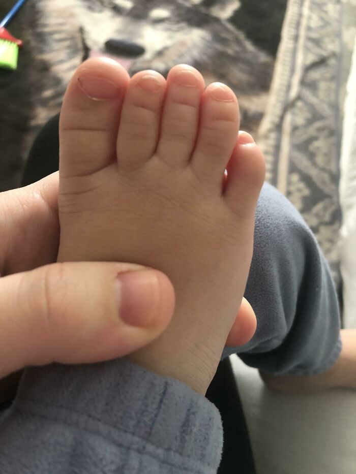 A person holding a baby's foot with unusually long toes, demonstrating body quirks.
