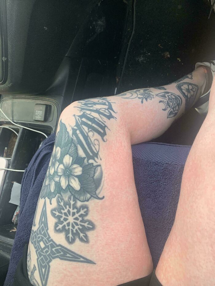 A leg with various tattoos and noticeable redness, highlighting unique body quirks.