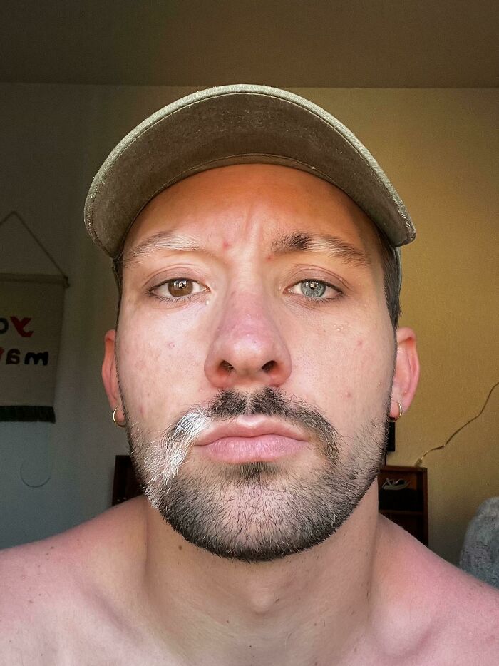 A man with heterochromia, one brown eye and one blue eye, and a white streak in his mustache, rare body quirks.