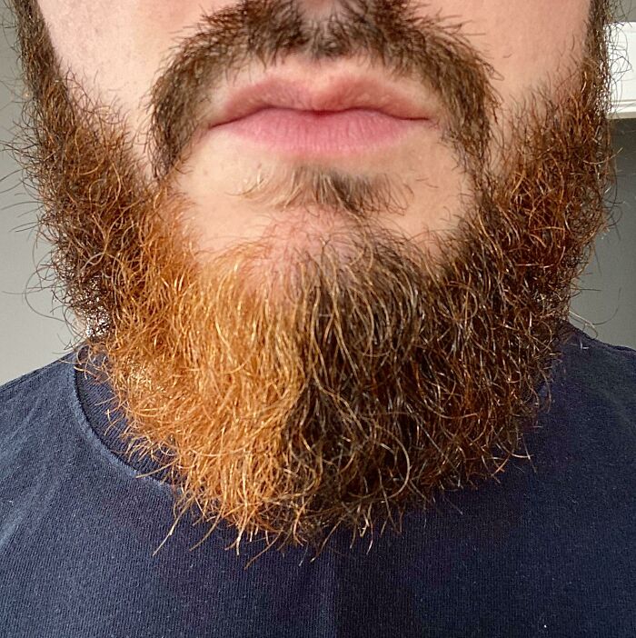 A close-up of a person's beard, displaying a striking two-tone color, a fascinating body quirk.