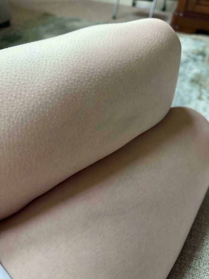 A person's arm covered in goosebumps, a common yet fascinating body quirk.
