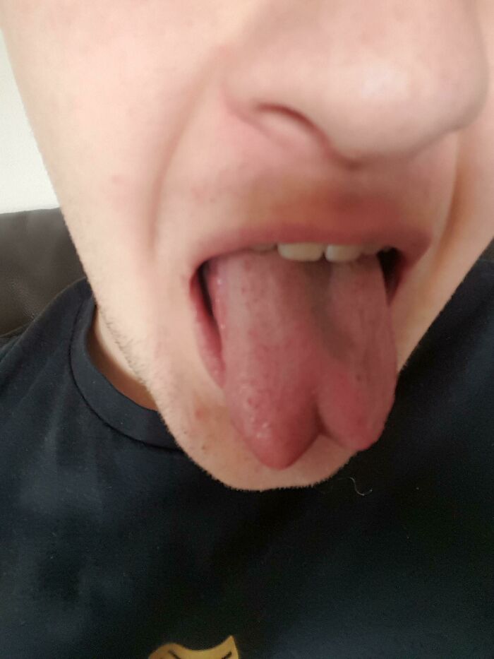 A close-up of a person's tongue, showing a deep cleft, a rare body quirk that left people fascinated.