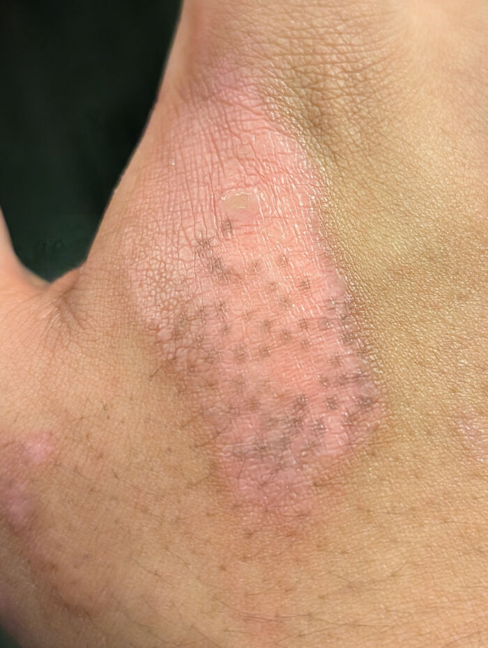 A close-up of skin with a textured pattern and discolored area, revealing a fascinating body quirk.