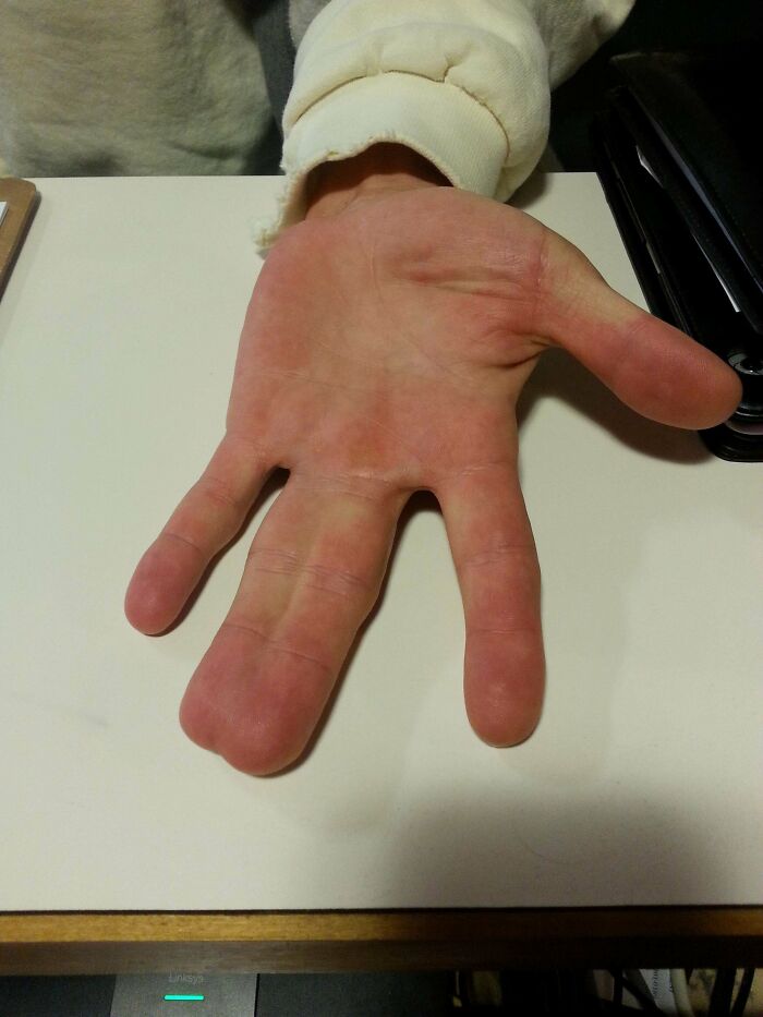 A person's hand with four fingers, two of which appear fused, a fascinating example of body quirks.