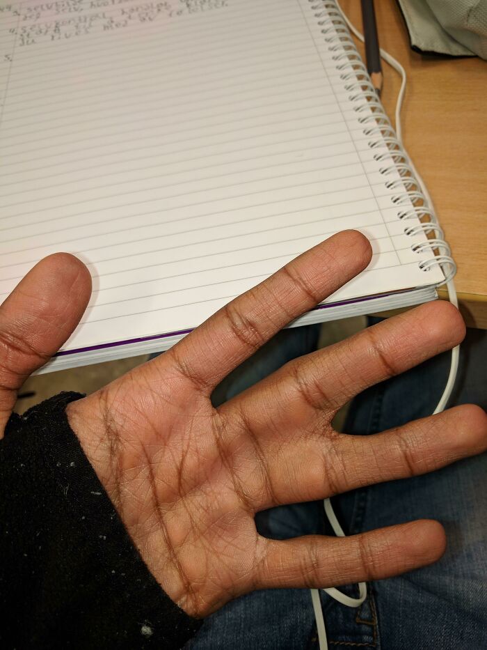 A hand with widely spaced fingers, demonstrating a fascinating body quirk.