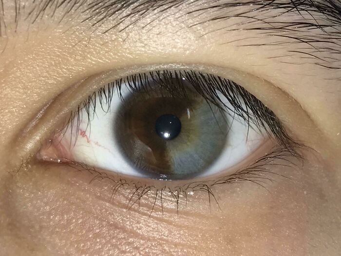 A close-up of an eye showing different colors in the iris, a fascinating body quirk.