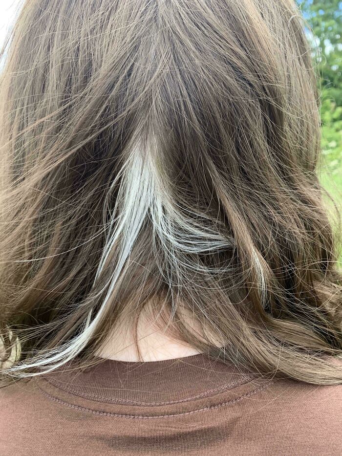 Close-up of the back of a person's head, revealing a prominent streak of white hair, a rare body quirk.